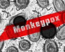 Is a new pandemic on the cards?